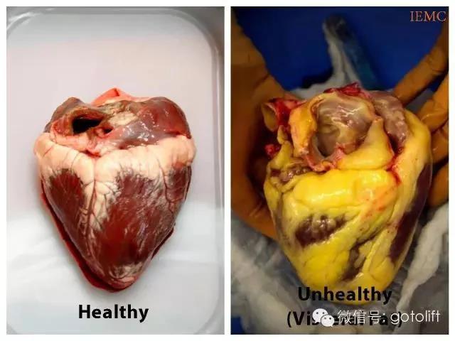 补硒右下腹痛(补硒右下腹痛)-硒宝网