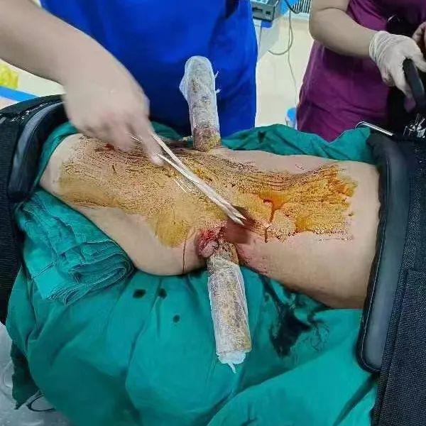 补硒后肚子胀（肚子胀补硒后会好吗）-硒宝网