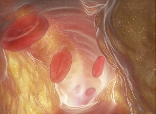 血脂高要补硒(补硒可以降血脂吗)-硒宝网