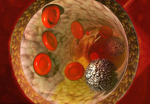 血脂高要补硒(补硒可以降血脂吗)-硒宝网