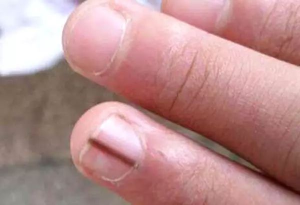 补硒会变黑么（硒变黑怎么回事）-硒宝网