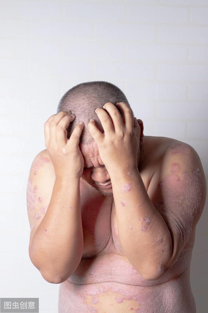 补硒胃不舒服（补硒能治疗肠胃）-硒宝网