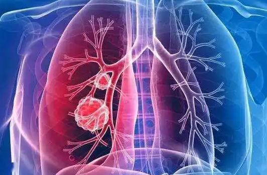 肺炎能补硒吗(硒对肺炎的原理)-硒宝网