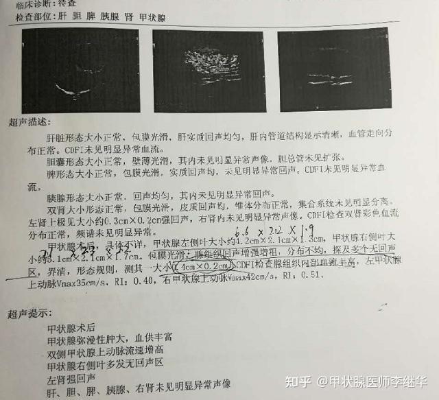 1岁宝宝补硒(宝宝补硒的食物有哪些)-硒宝网