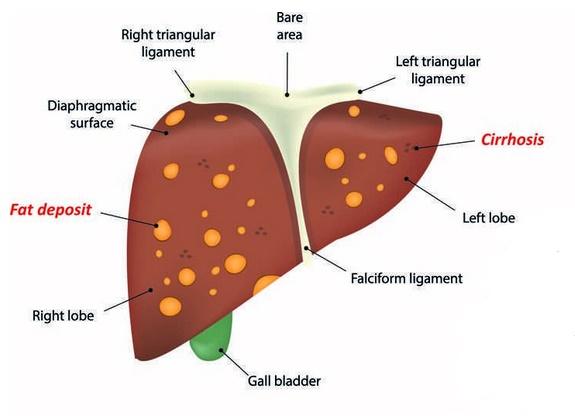 乙肝用补硒吗（乙肝补硒有什么副作用）-硒宝网