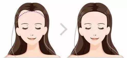 女生补硒掉发(补硒女性)-硒宝网