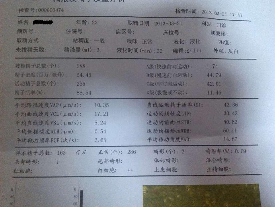 锌硒可以补精(锌硒片能生精吗)-硒宝网