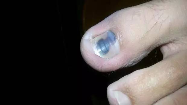 补硒子宫增厚（增厚子宫的药有没有）-硒宝网