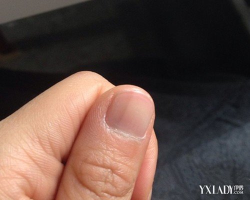 补硒子宫增厚（增厚子宫的药有没有）-硒宝网