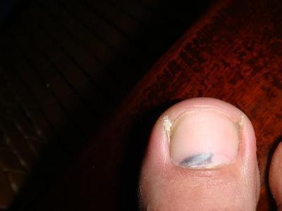 补硒子宫增厚（增厚子宫的药有没有）-硒宝网