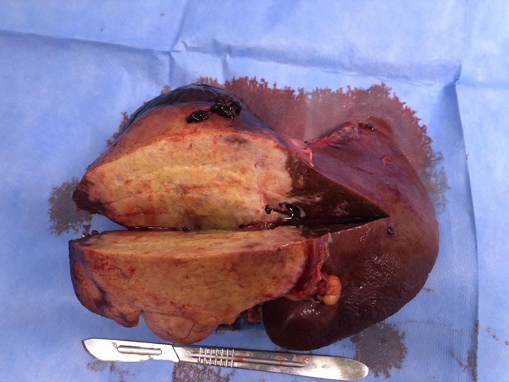 黄硒素怎么补(黄硒素多少钱)-硒宝网