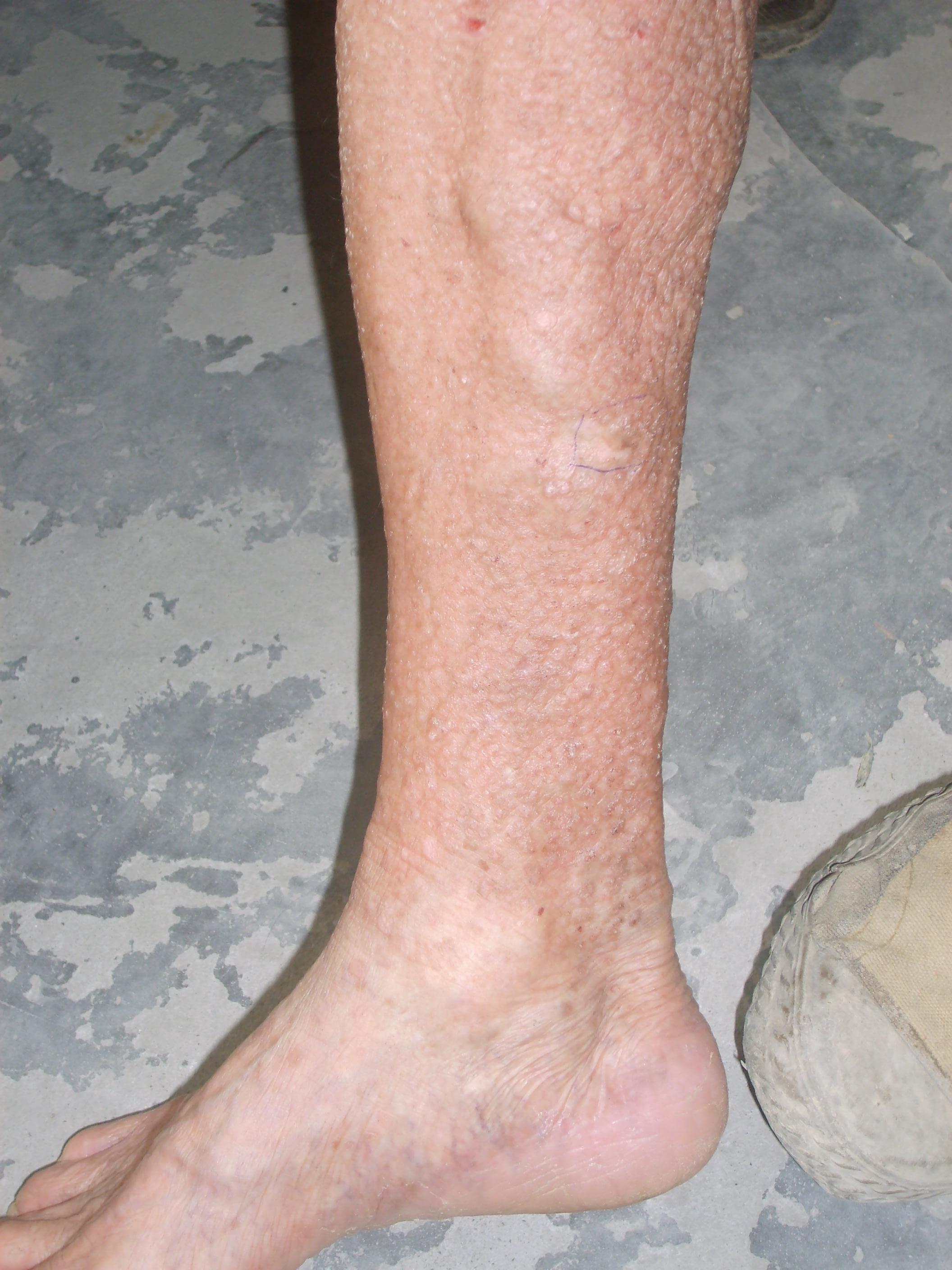 深露补硒胶囊（硒胶囊的副作用）-硒宝网