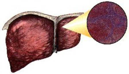 肝带菌怎补硒(补硒肝脏)-硒宝网