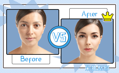 睡前吃补硒药(补硒影响睡觉吗)-硒宝网