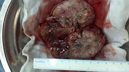 咳嗽能补硒吗（硒与咳嗽）-硒宝网