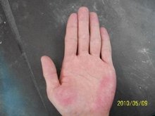 补硒养肝方法（补硒养肝食物）-硒宝网