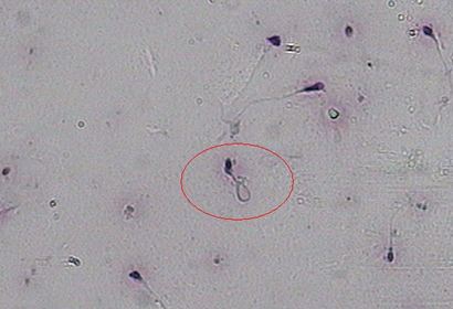 孕妇要补硒么(孕期补硒)-硒宝网