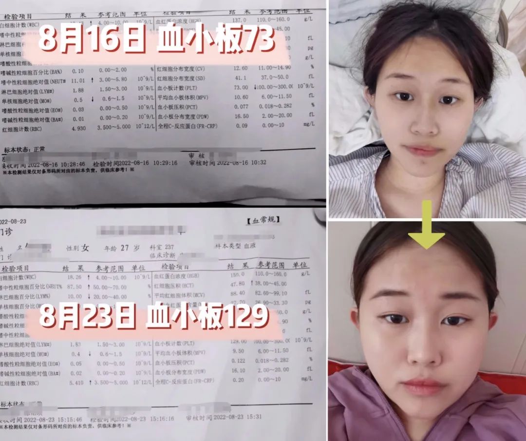 每天补一粒硒(每天补硒后肝脏变化案例)-硒宝网