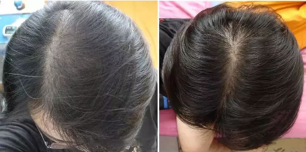 每天补一粒硒(每天补硒后肝脏变化案例)-硒宝网