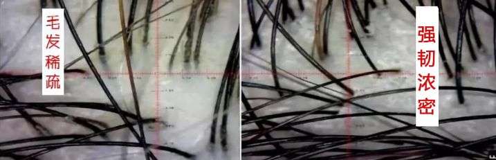 每天补一粒硒(每天补硒后肝脏变化案例)-硒宝网