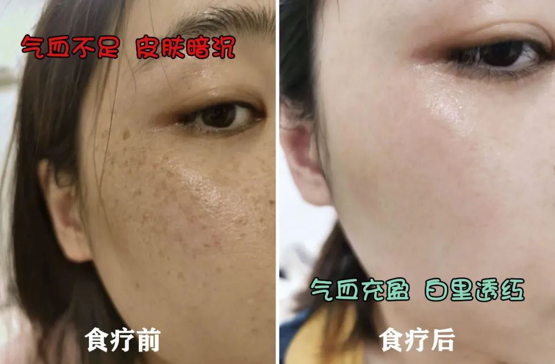 每天补一粒硒(每天补硒后肝脏变化案例)-硒宝网