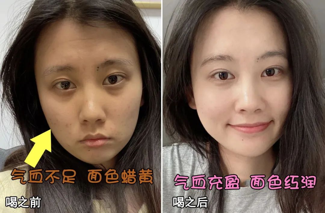 每天补一粒硒(每天补硒后肝脏变化案例)-硒宝网