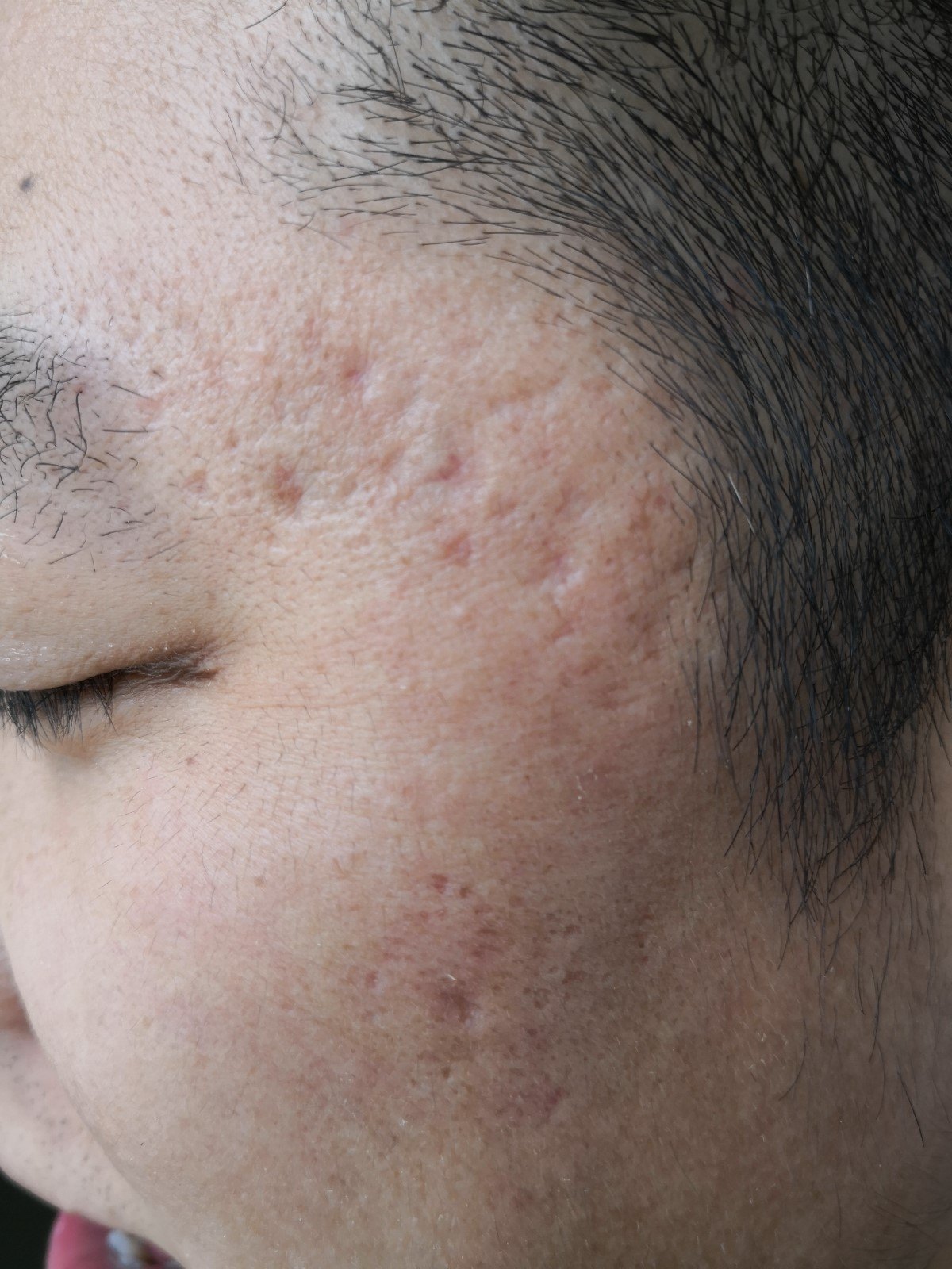 胃寒能补硒吗（硒对胃病的作用）-硒宝网