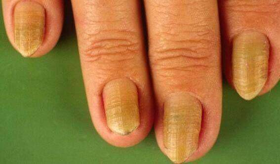 补硒能护肝吗（补硒对肝病有效吗）-硒宝网