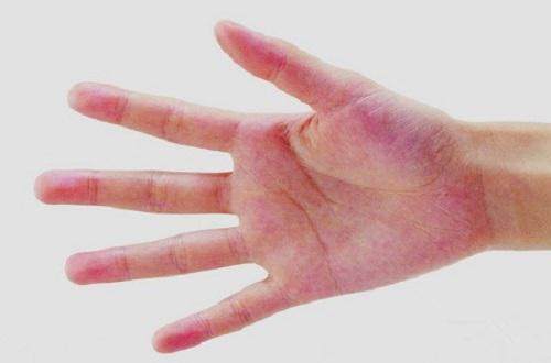 补硒能护肝吗（补硒对肝病有效吗）-硒宝网