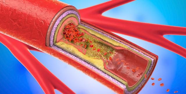 补硒与治未?。ú刮苤尾÷穑?硒宝网