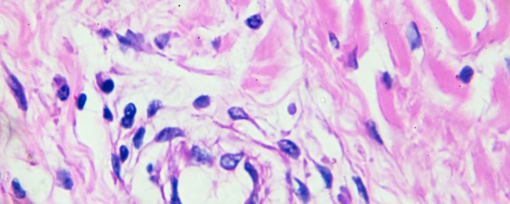 补硒最好办法（最好的补硒方法）-硒宝网