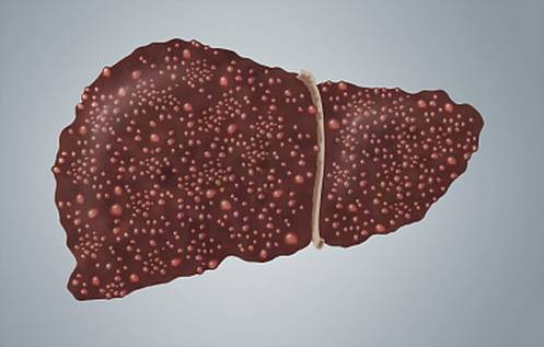 补硒能祛湿吗（硒对湿疹有作用没）-硒宝网