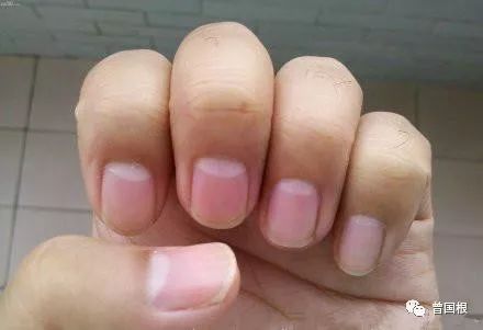 补硒的肝功能(补硒肝脏)-硒宝网