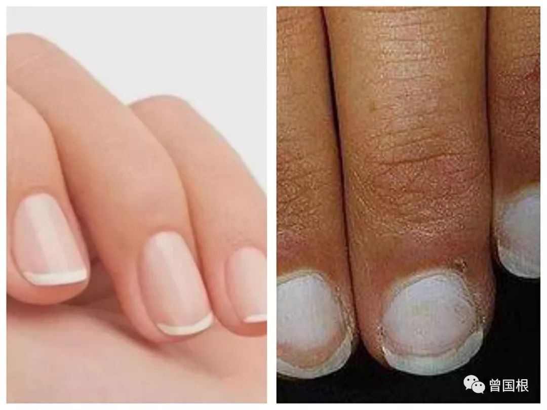 补硒的肝功能(补硒肝脏)-硒宝网