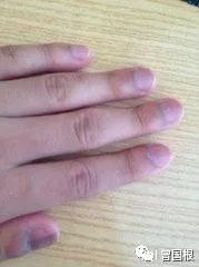 补硒的肝功能(补硒肝脏)-硒宝网