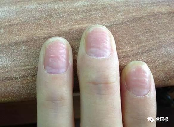 补硒的肝功能(补硒肝脏)-硒宝网