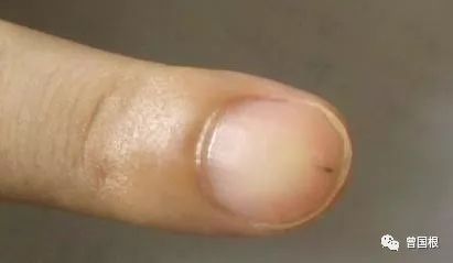 补硒的肝功能(补硒肝脏)-硒宝网