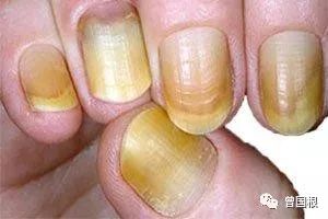 补硒的肝功能(补硒肝脏)-硒宝网