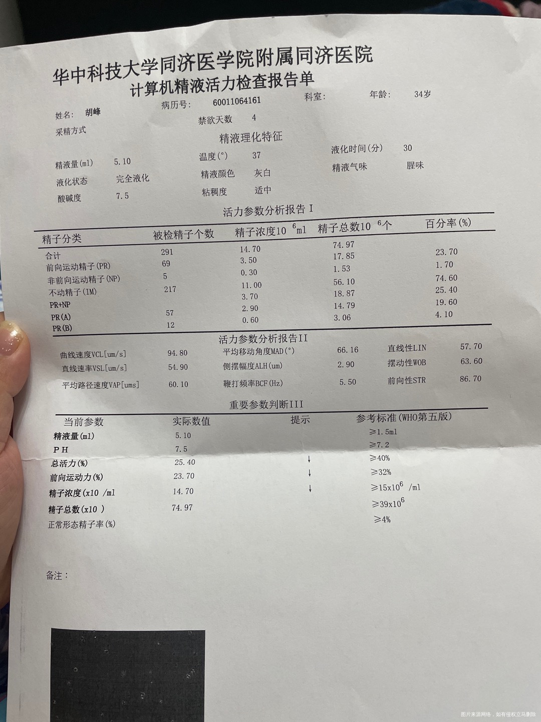 补硒能生精吗（弱精补硒）-硒宝网