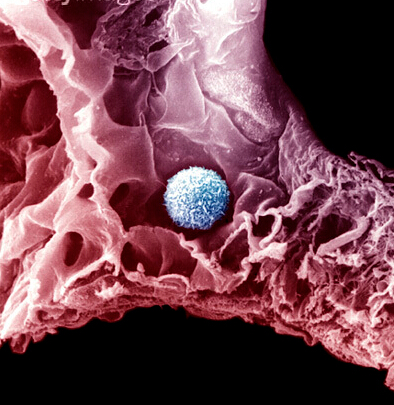 淋巴瘤补硒吗(补硒对淋巴结肿大有影响吗)-硒宝网