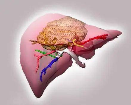 肝病患者补硒（补硒对肝病患者有好处吗）-硒宝网