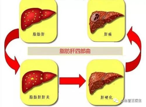 硒补脂肪肝吗（脂肪肝吃硒有什么用）-硒宝网