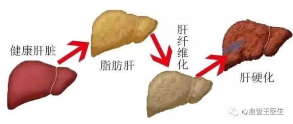 硒补脂肪肝吗（脂肪肝吃硒有什么用）-硒宝网