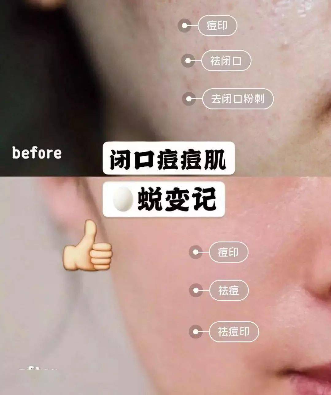 女生补锌会增加雌性激素吗(女生补雌性激素的影响)-硒宝网