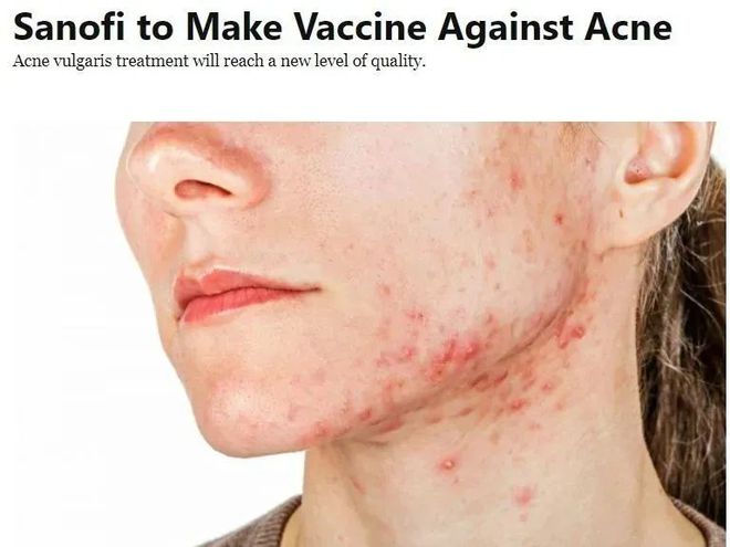 女生补锌会增加雌性激素吗(女生补雌性激素的影响)-硒宝网