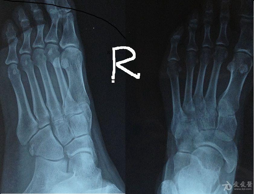补钙哪个钙片好(补钙钙片好还是牛奶好)-硒宝网