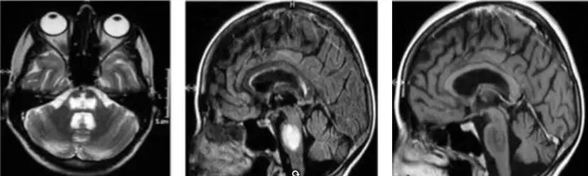 怎么补钠(钠补多了会出现什么症状)-硒宝网