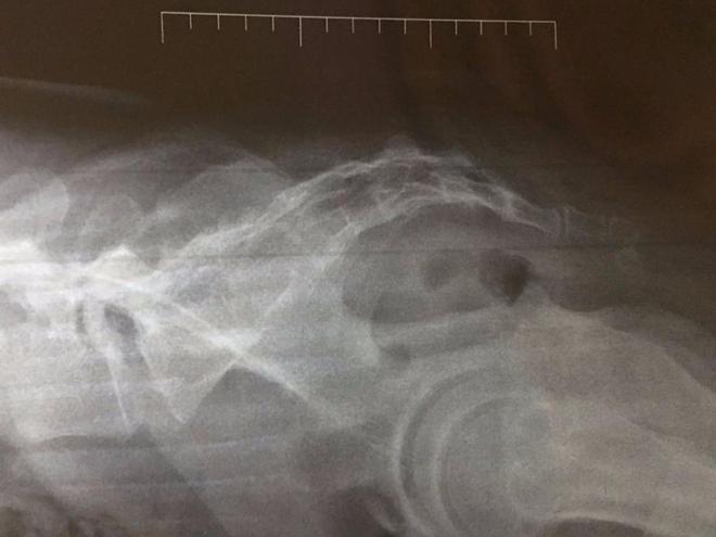 吃豆腐补钙吗(吃豆腐补钙不)-硒宝网