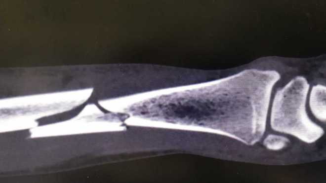 吃豆腐补钙吗(吃豆腐补钙不)-硒宝网