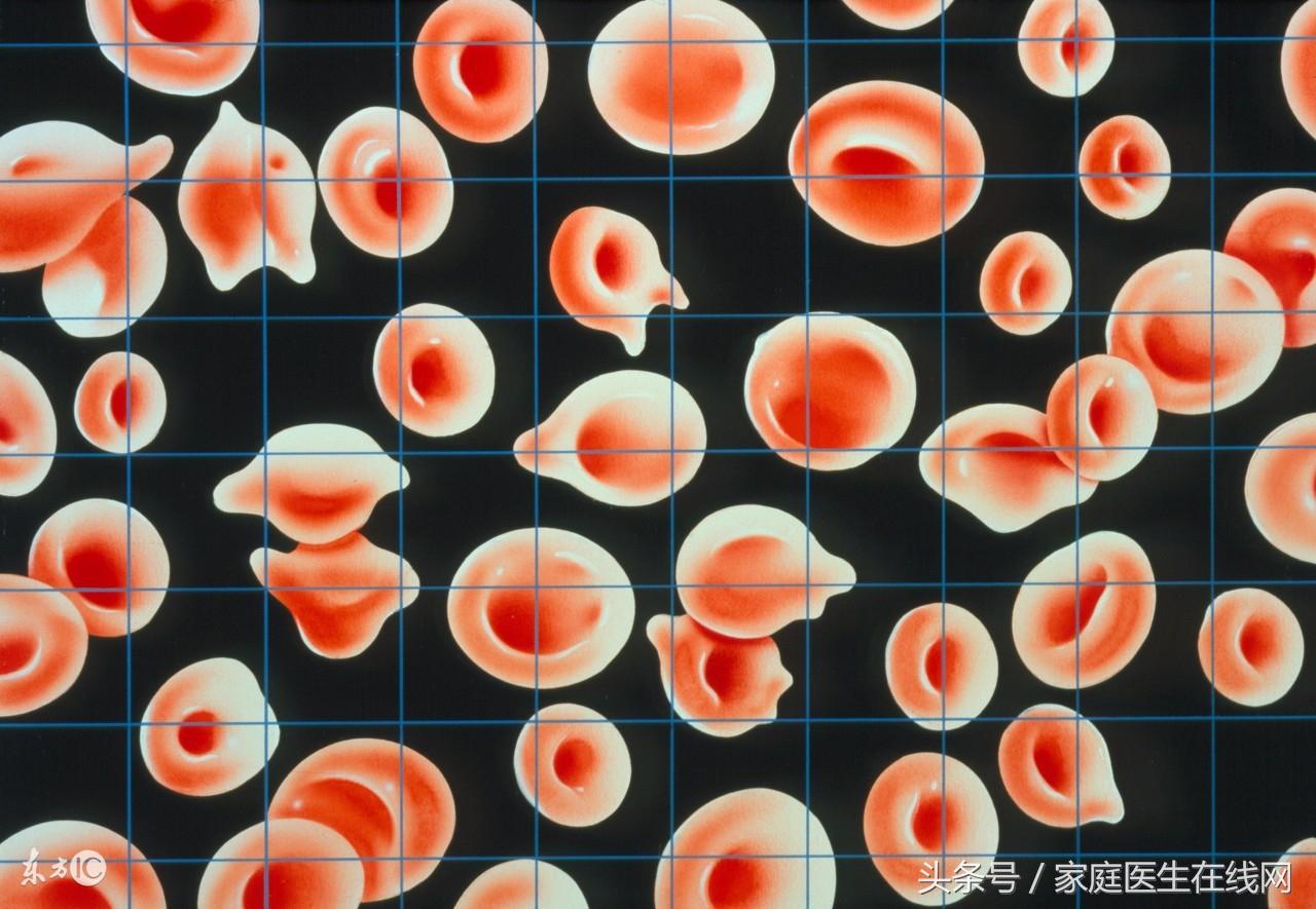 食补铁什么食物最佳（铁食补）-硒宝网